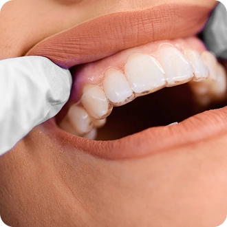 3rd photo of the gallery