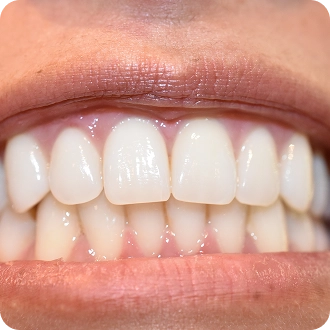 19th photo of the gallery