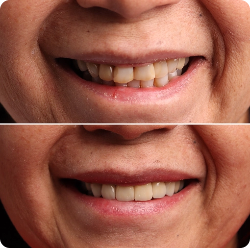 1st photo of the gallery