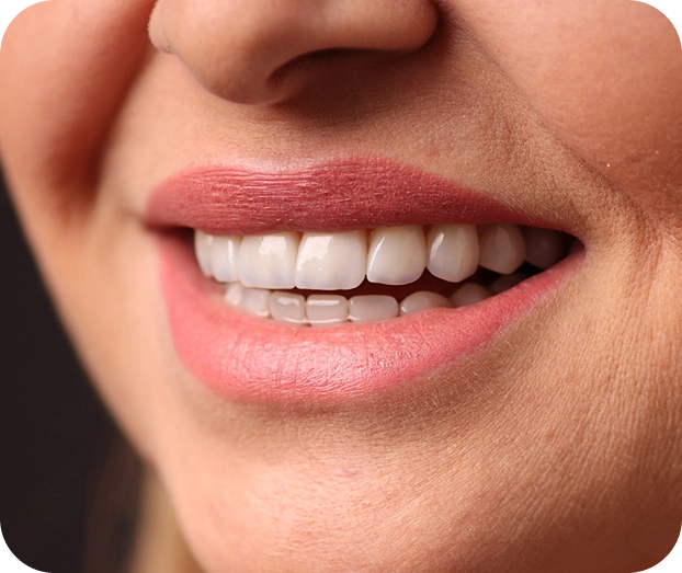 Close-up of a patient's smile after oral surgery treatment at Restore Dental in Peabody, MA