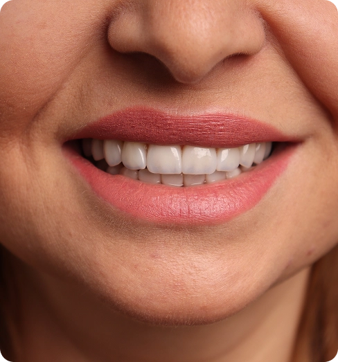 Close-up of a patient's smile after cosmetic treatment at Restore Dental in Peabody, MA