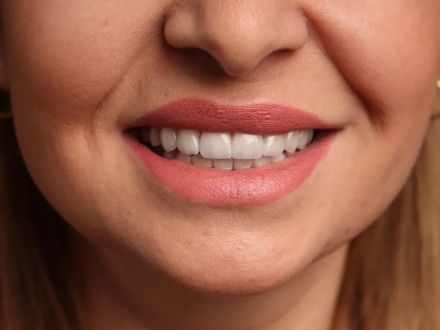 Patient smiling after treatment, photographed in natural light
